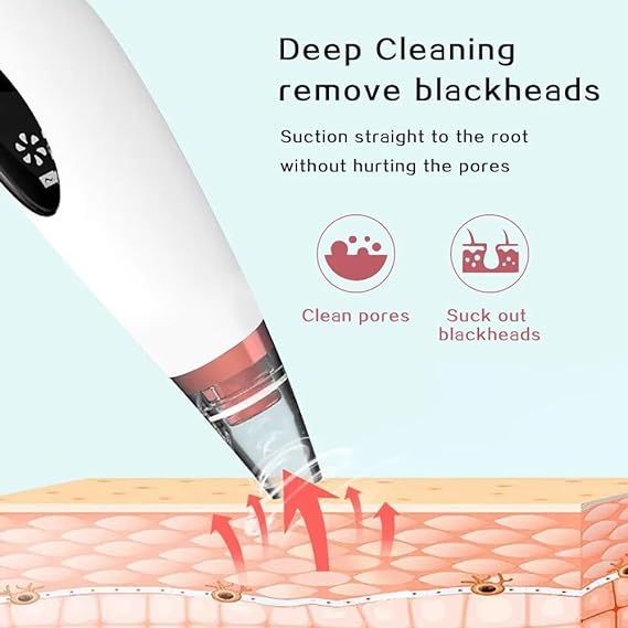 Vacuum Remover for Blackheads Acne & Black Spots Removal
